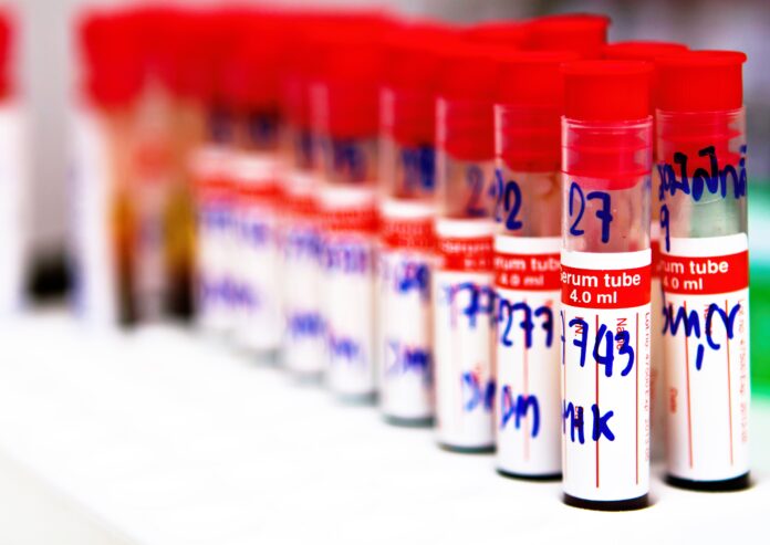 exame de sangue, dengue. testes de dengue