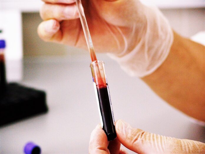 exame sangue colesterol